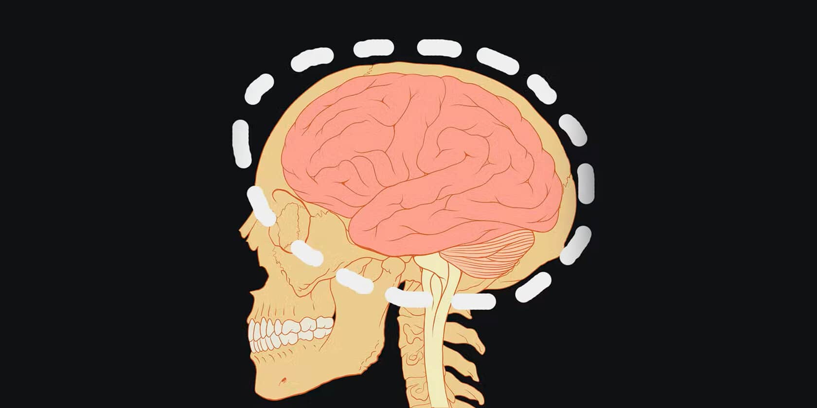 Нет мозга — нет боли: она в уме, поэтому результаты анализов могут ухудшить ситуацию. Лоример Мозли